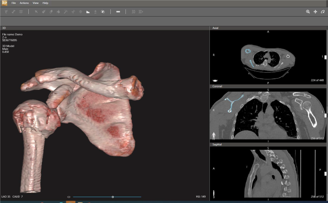 dicom-to-print.png dicom-to-print.png